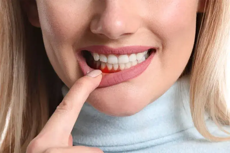 Periodontologia